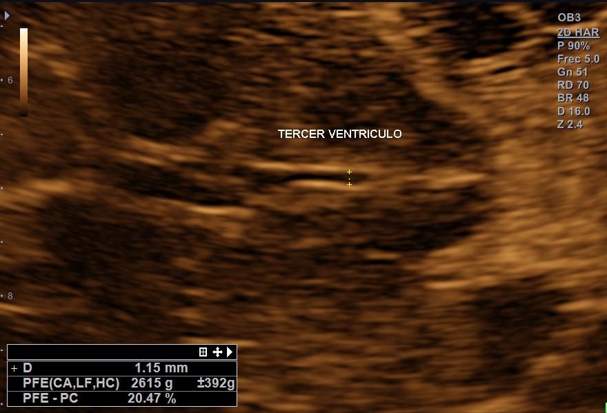 Benjamín Villarroel Castillo-7