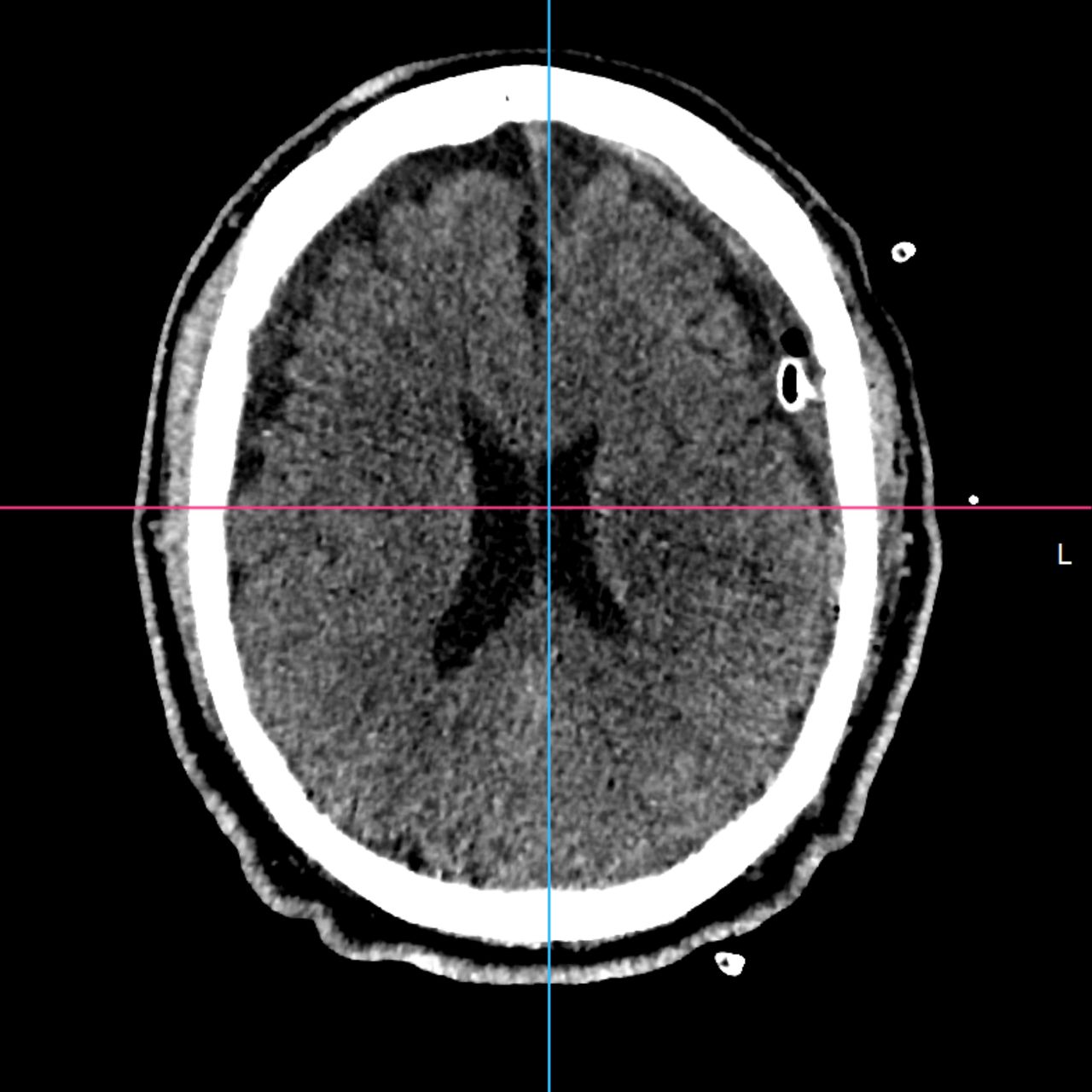 David Tafur Muñoz-2475