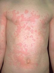 Antonio Carlos Biel-26