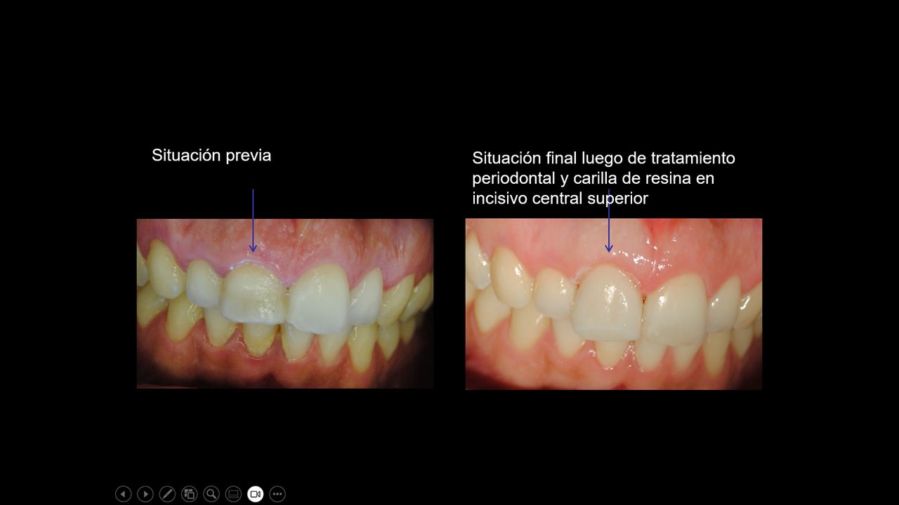 Sebastián Vicente-7