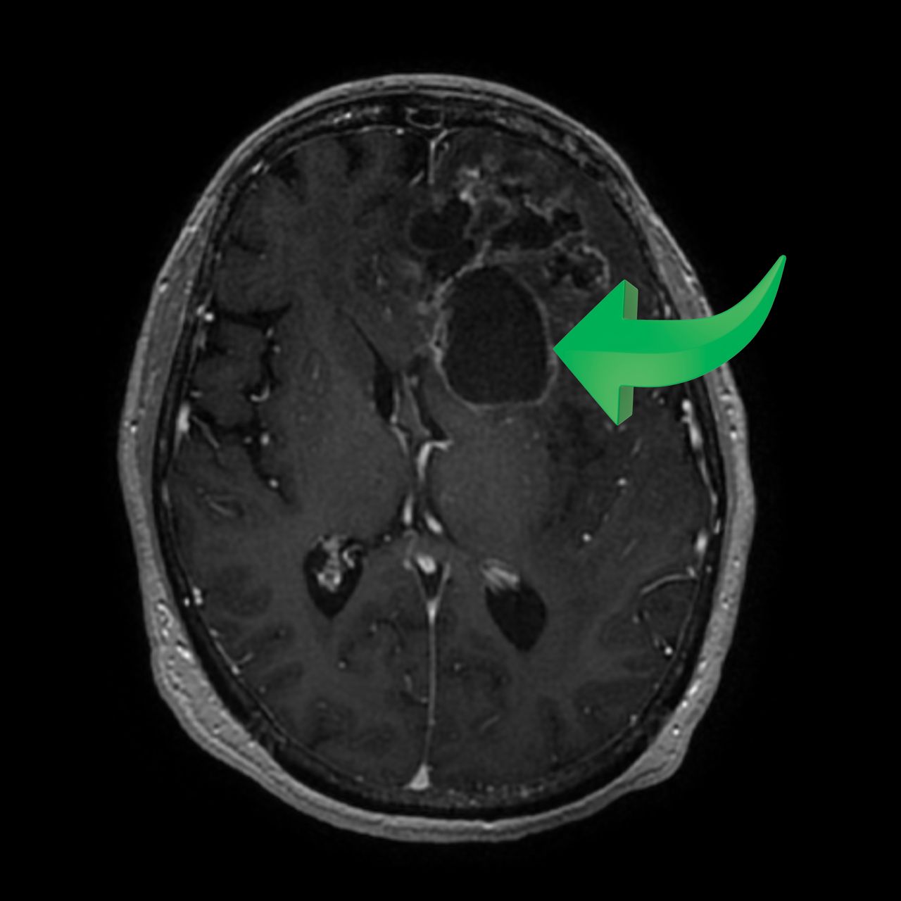 David Tafur Muñoz-1118