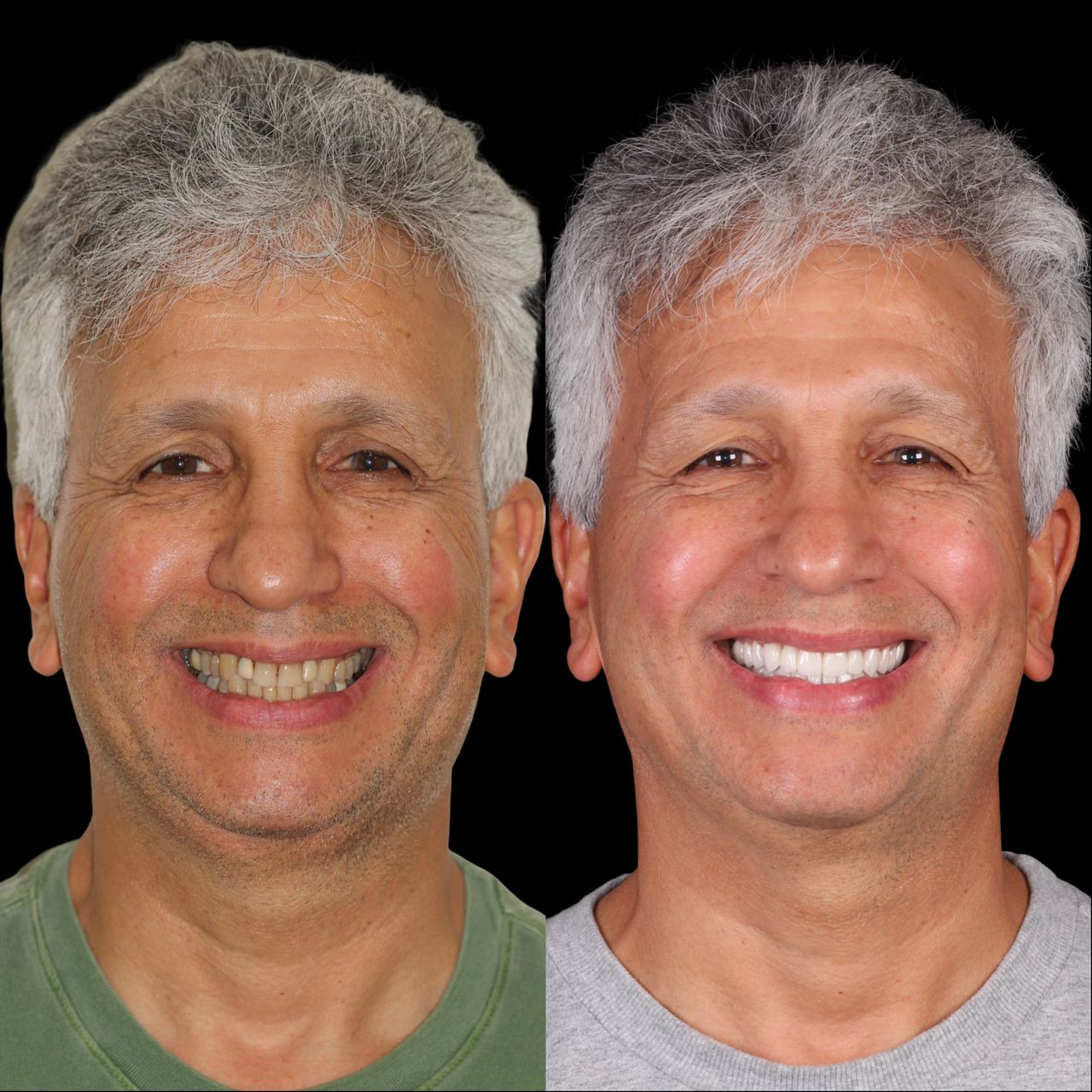 Caroline Benedeti-15