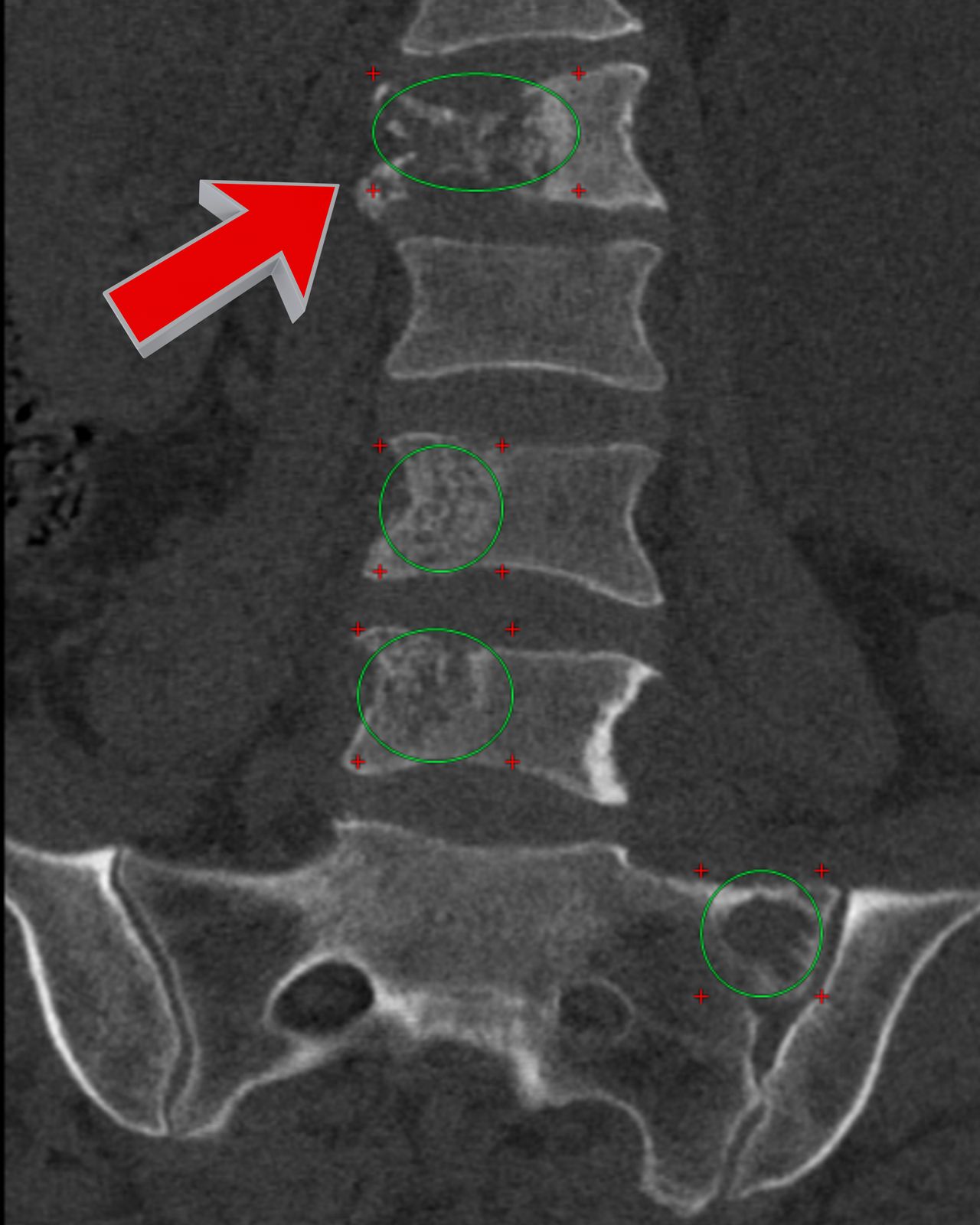 David Tafur Muñoz-1905