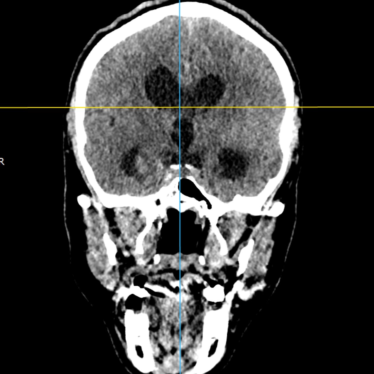 David Tafur Muñoz-2359