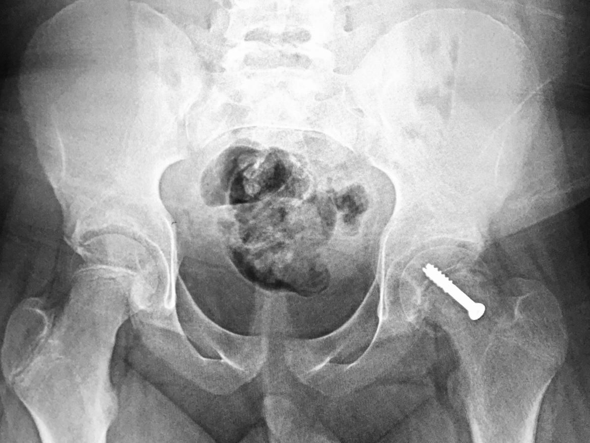 Jônatas Laurindo Giacomini-17