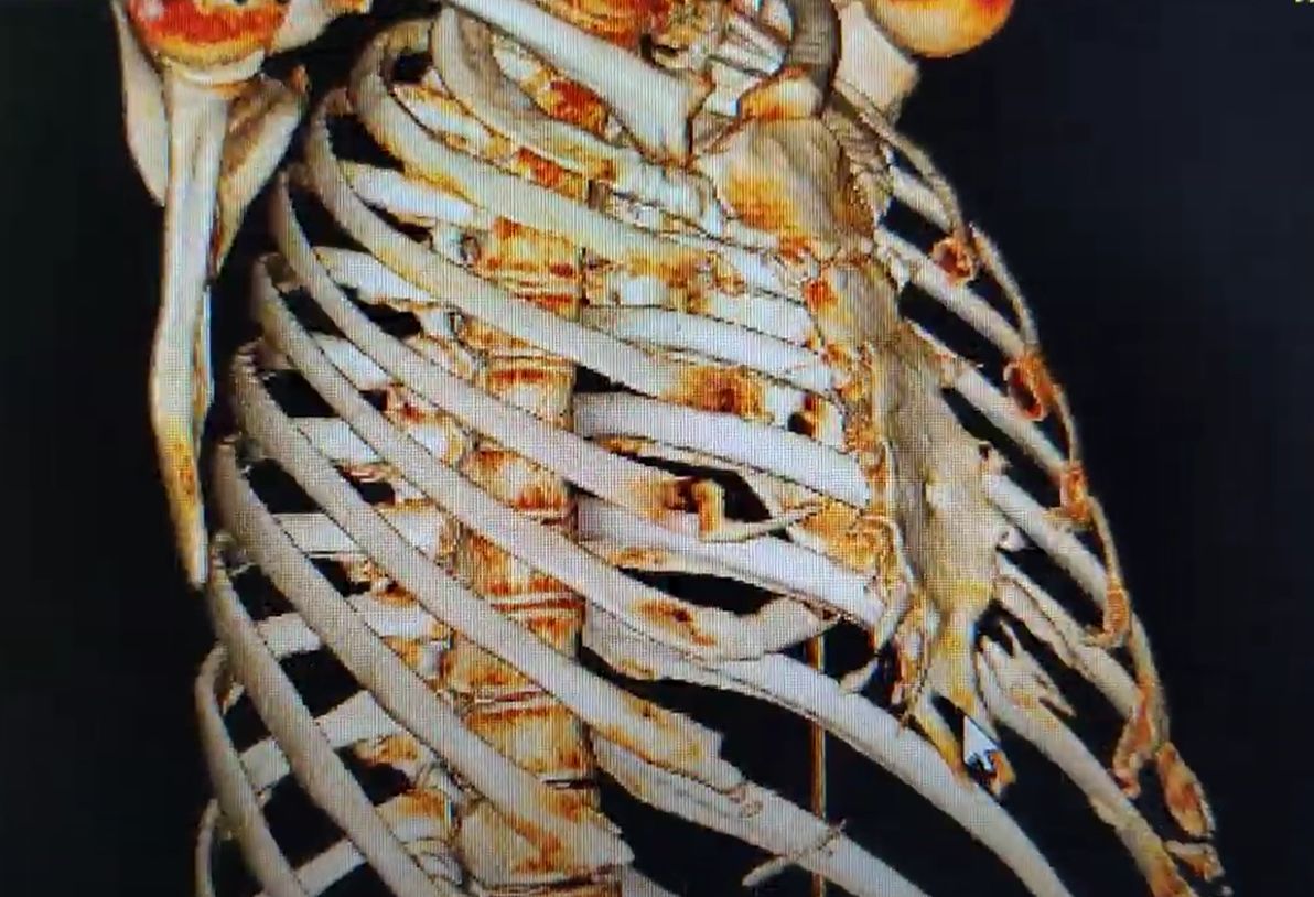 Willfredy Castaño Ruiz-21