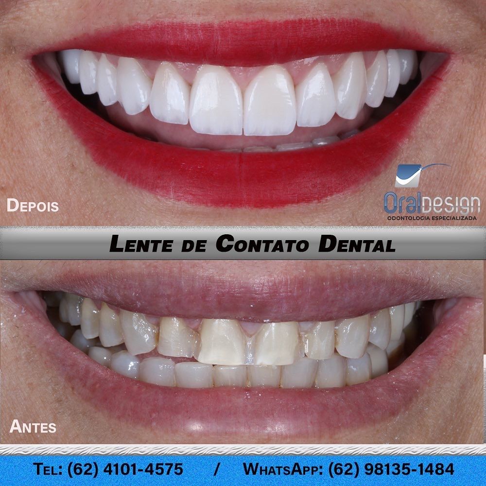 Danilo Monteiro Rezende Pereira-20