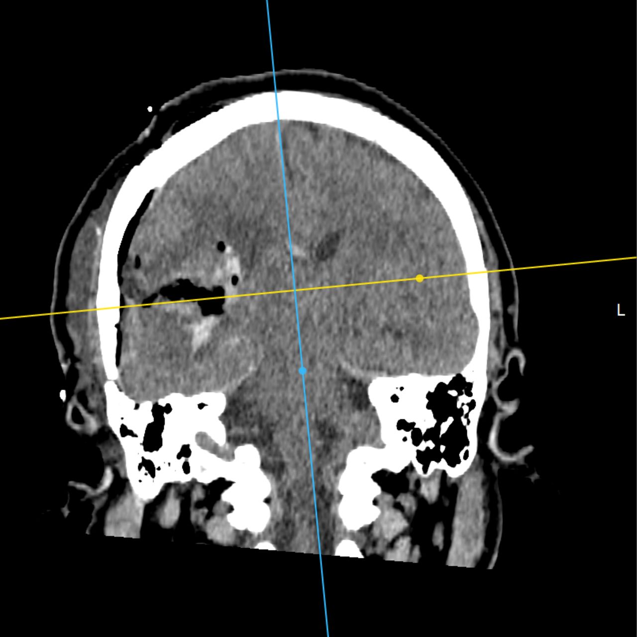 David Tafur Muñoz-2004