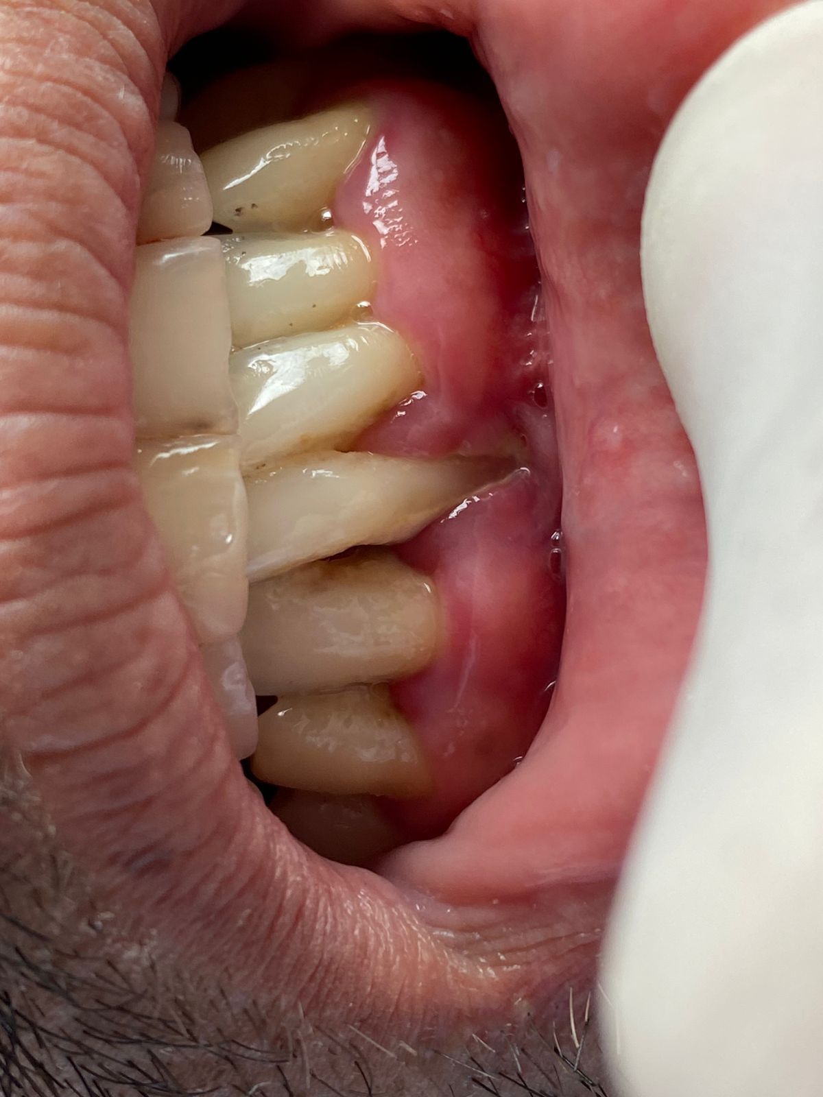 Francisco De Assis Almeida Lima Júnior-27