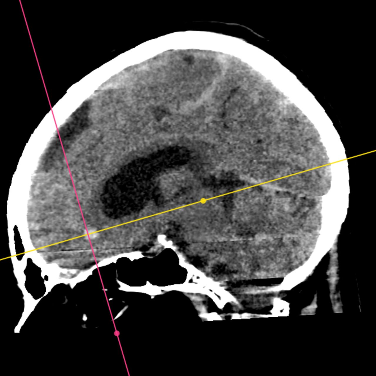 David Tafur Muñoz-1667