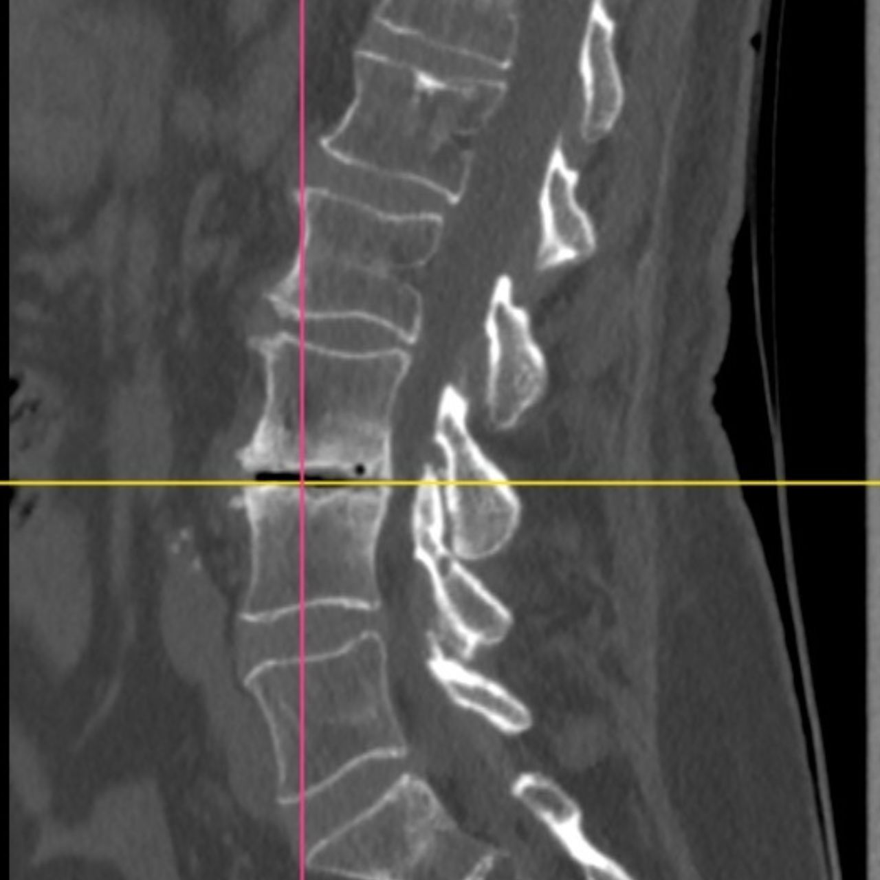 David Tafur Muñoz-1672