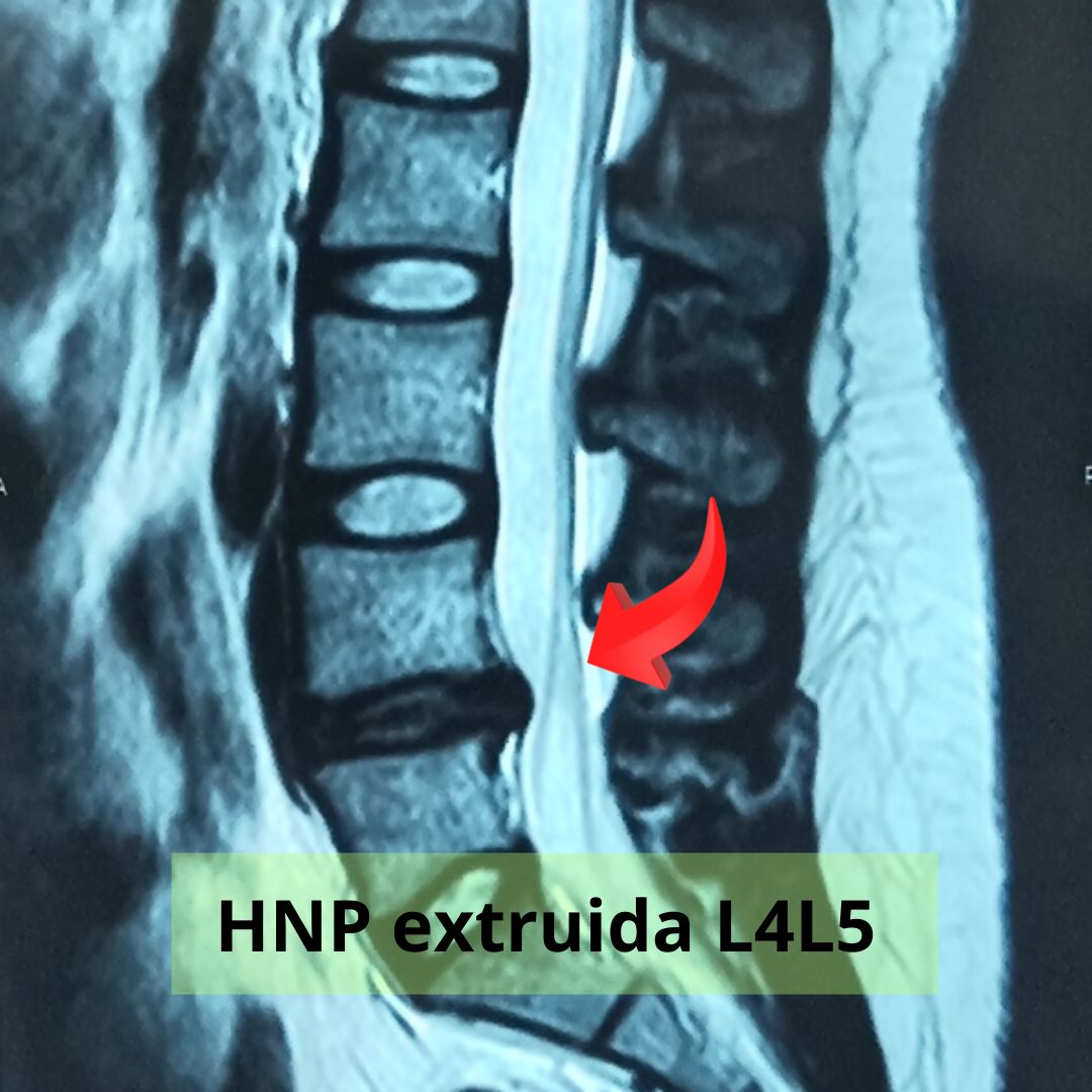 David Tafur Muñoz-1883