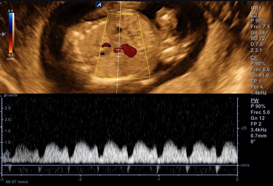 Benjamín Villarroel Castillo-14