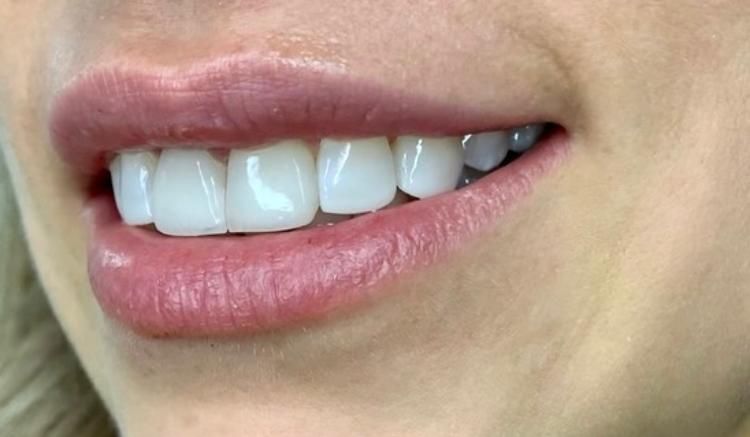 Juan Camilo Castillo-10