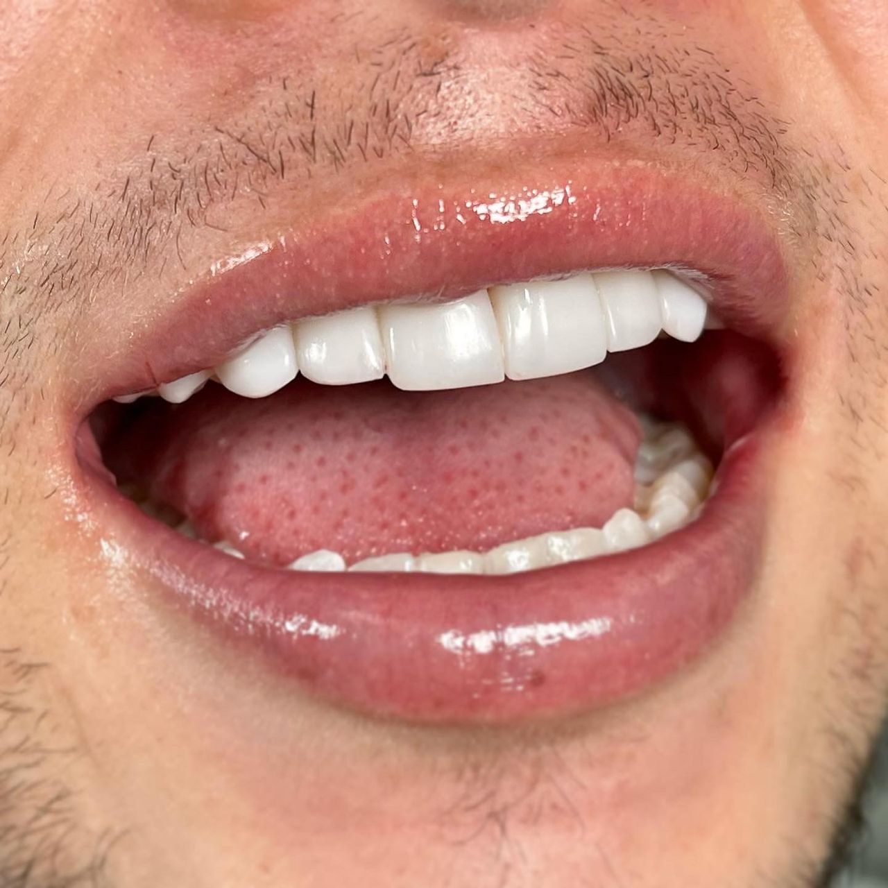 Franci Yulied López Jiménez-15