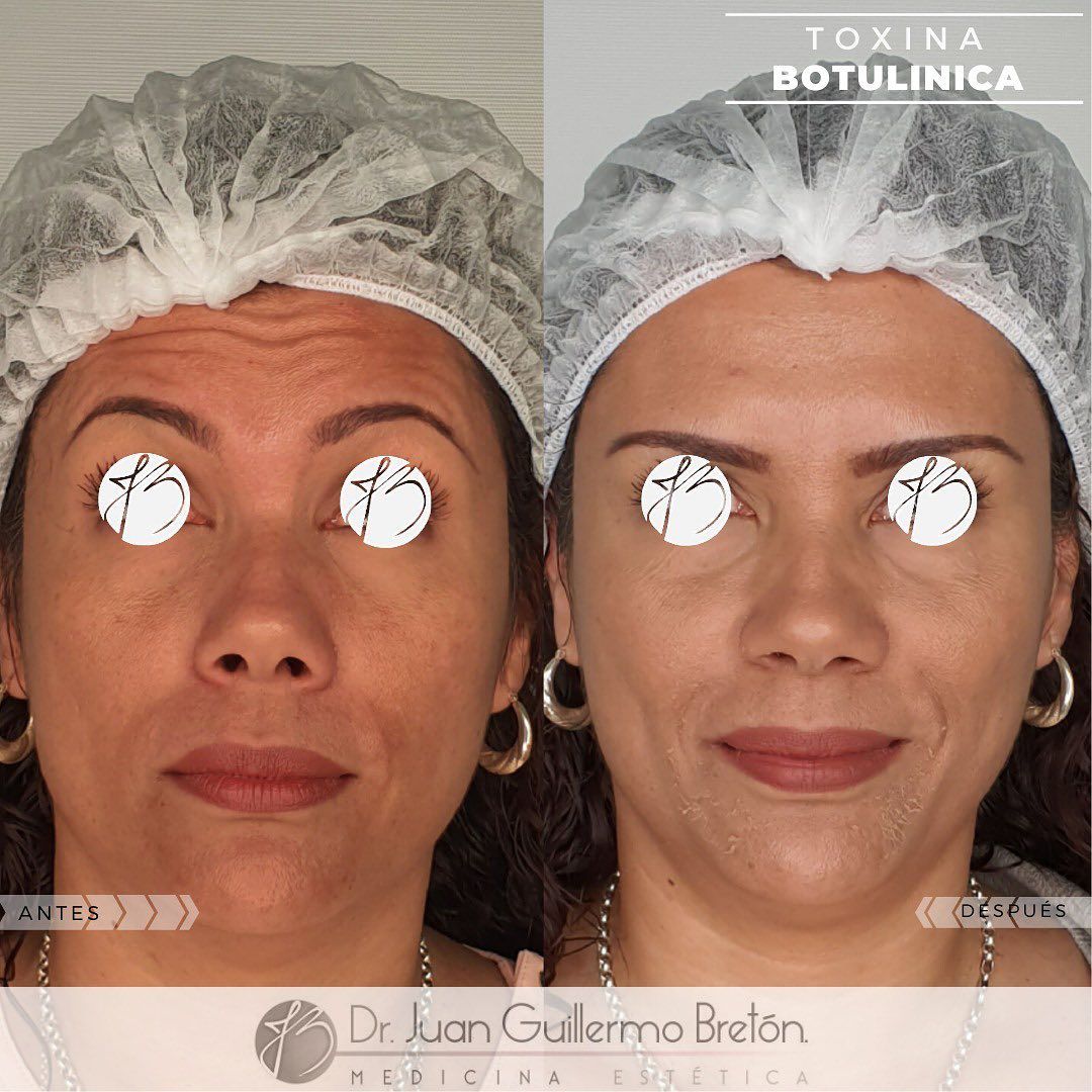 Juan Guillermo Bretón Franco-16