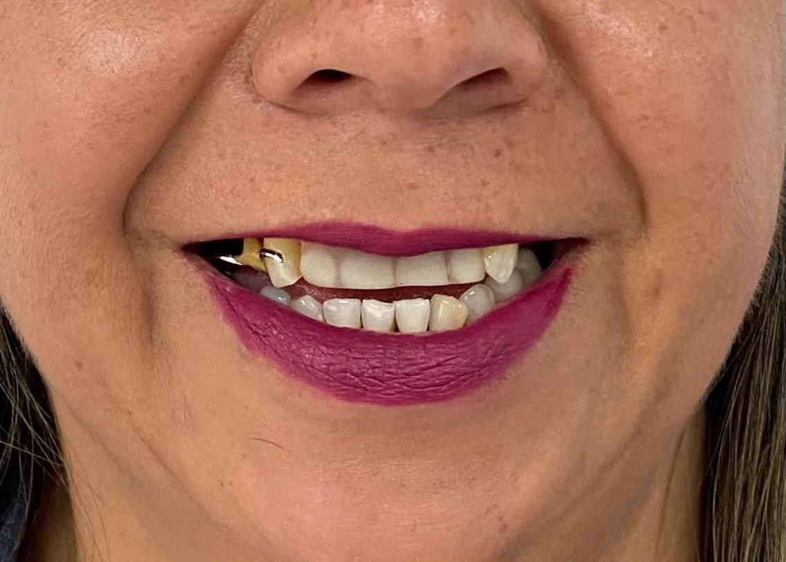 Francisco Bahamonde-12