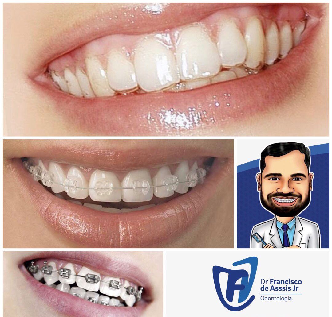 Francisco De Assis Almeida Lima Júnior-5