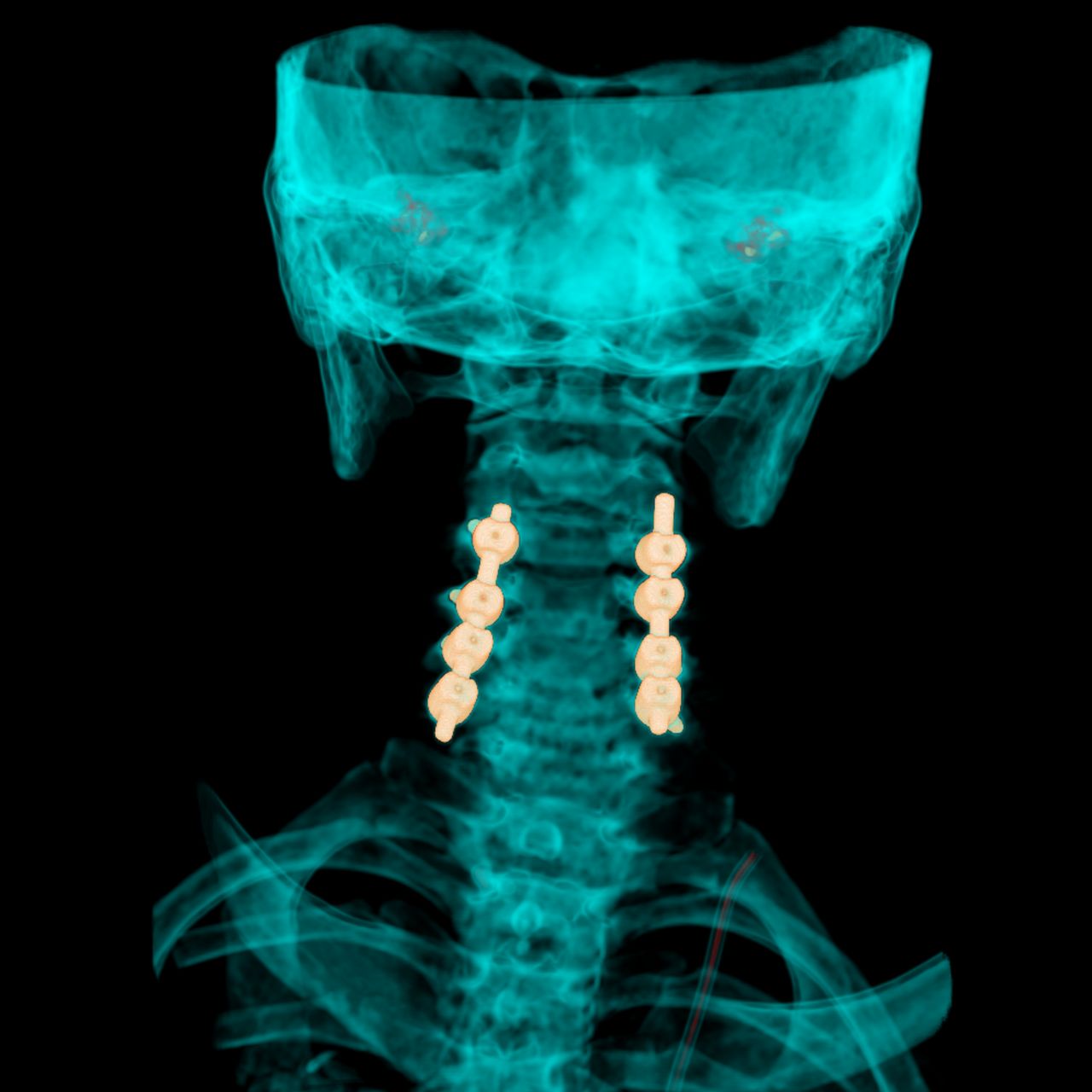 David Tafur Muñoz-1860