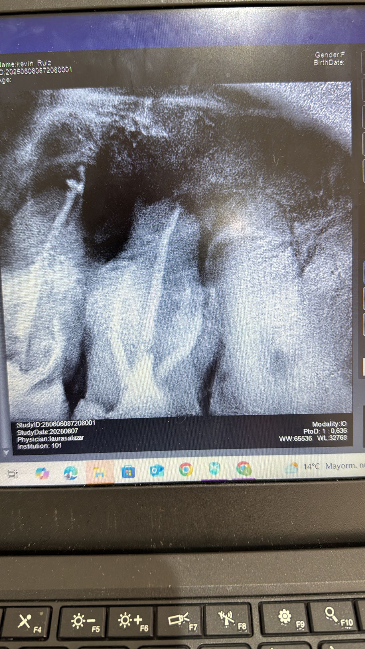 Laura Milena Salazar Monsalve-6