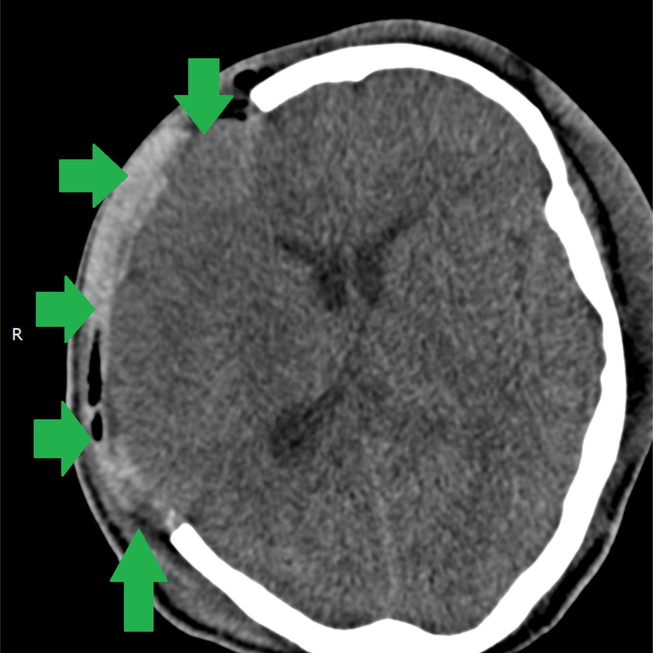 David Tafur Muñoz-1681