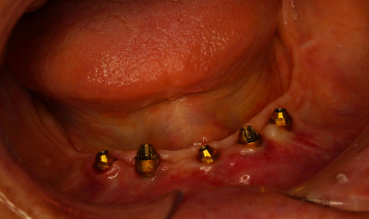 Juan Carlos Gac Pasten-11