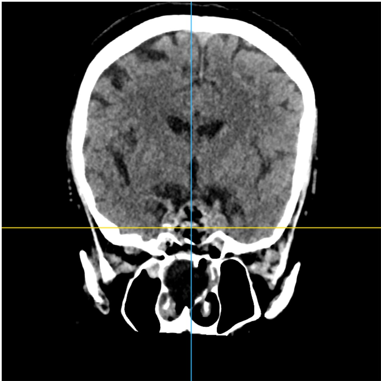 David Tafur Muñoz-2092