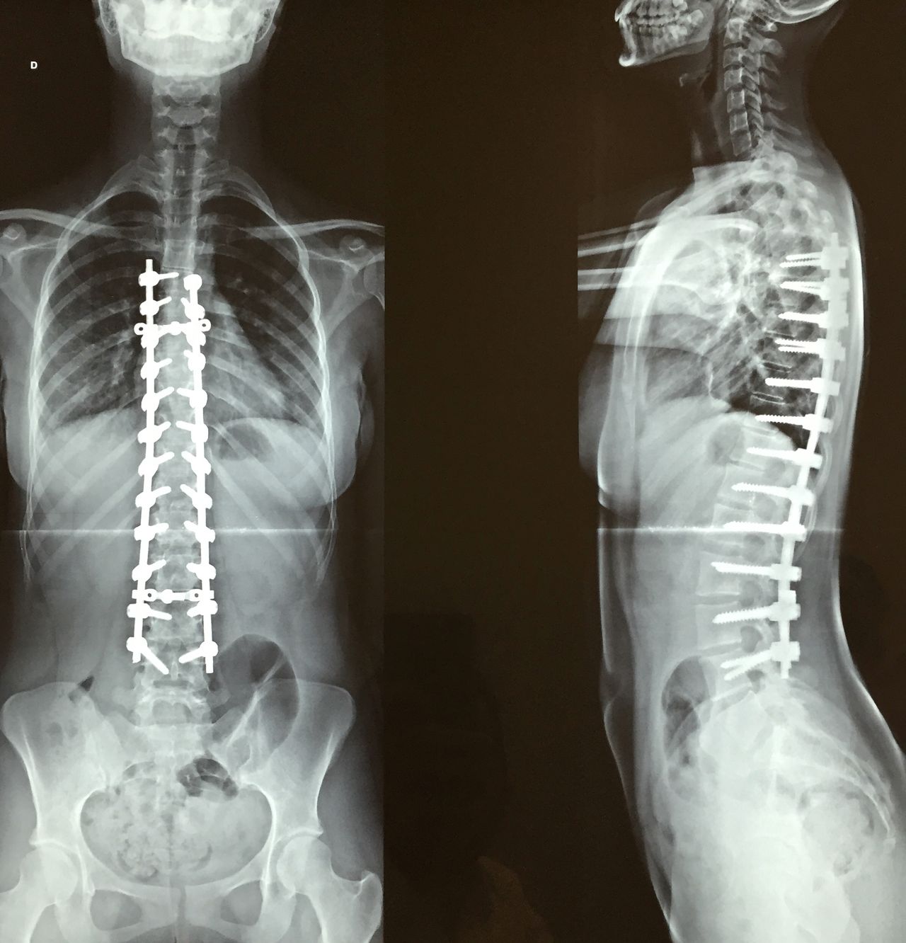 Henrique De Noronha-15