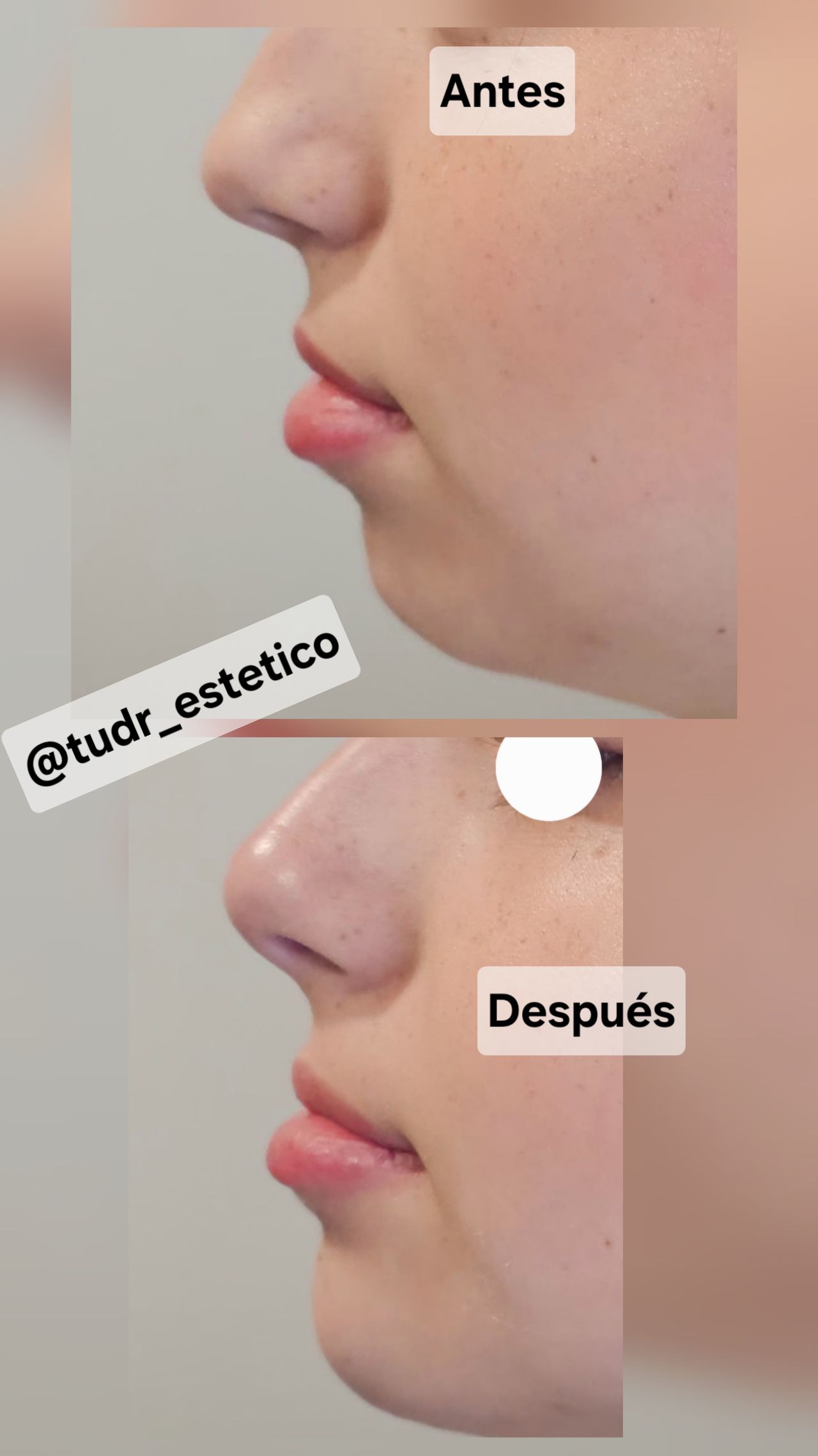 Diego Indriago Arias-22