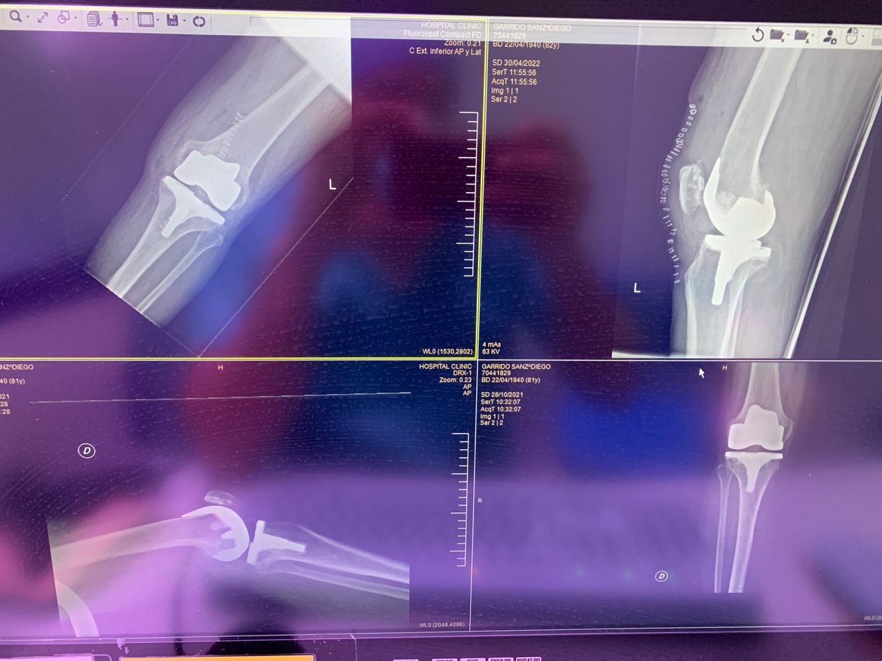 Miguel Angel Osorio Garcia-2