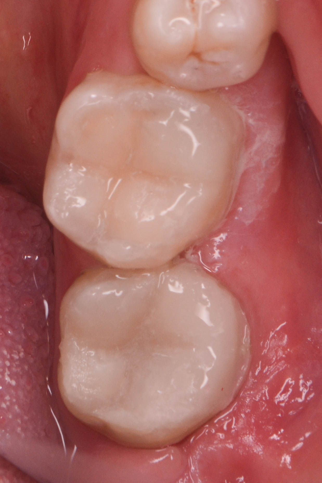 Edith Molina Miranda-4