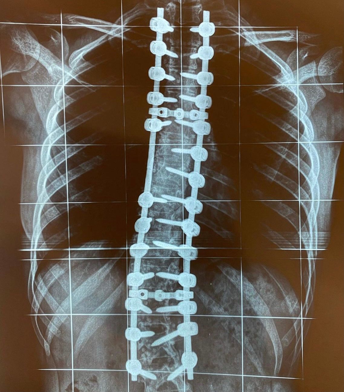 Carlos Eduardo Narciso Sakai-1