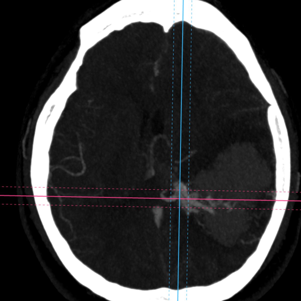 David Tafur Muñoz-1771