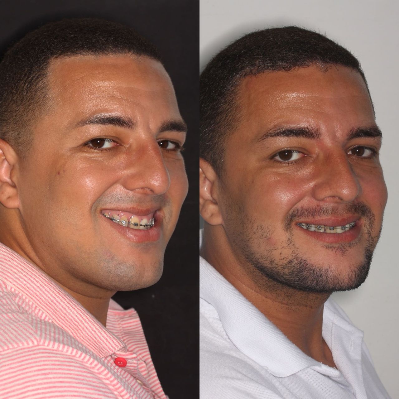 Raffael Maron Vieira De Noronha-11