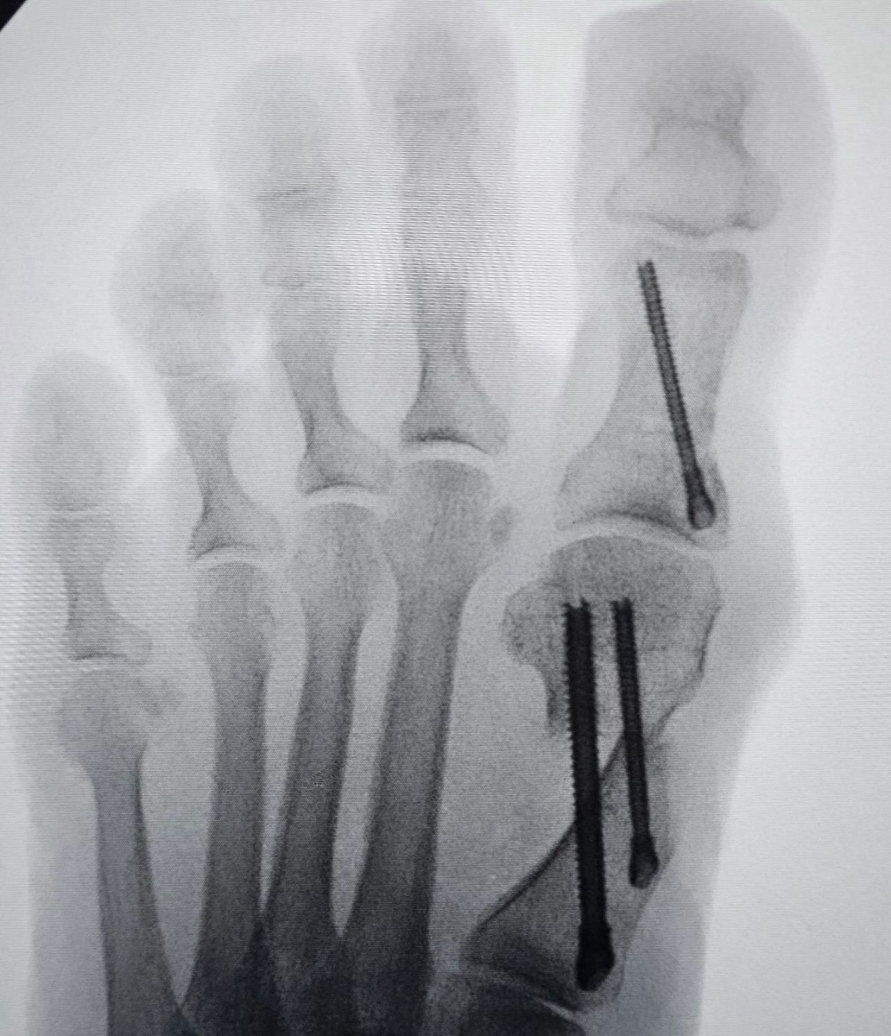 Leandro Jacomassi Machado-14