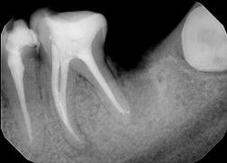 Hernán Andrés Febre Moscoso-12