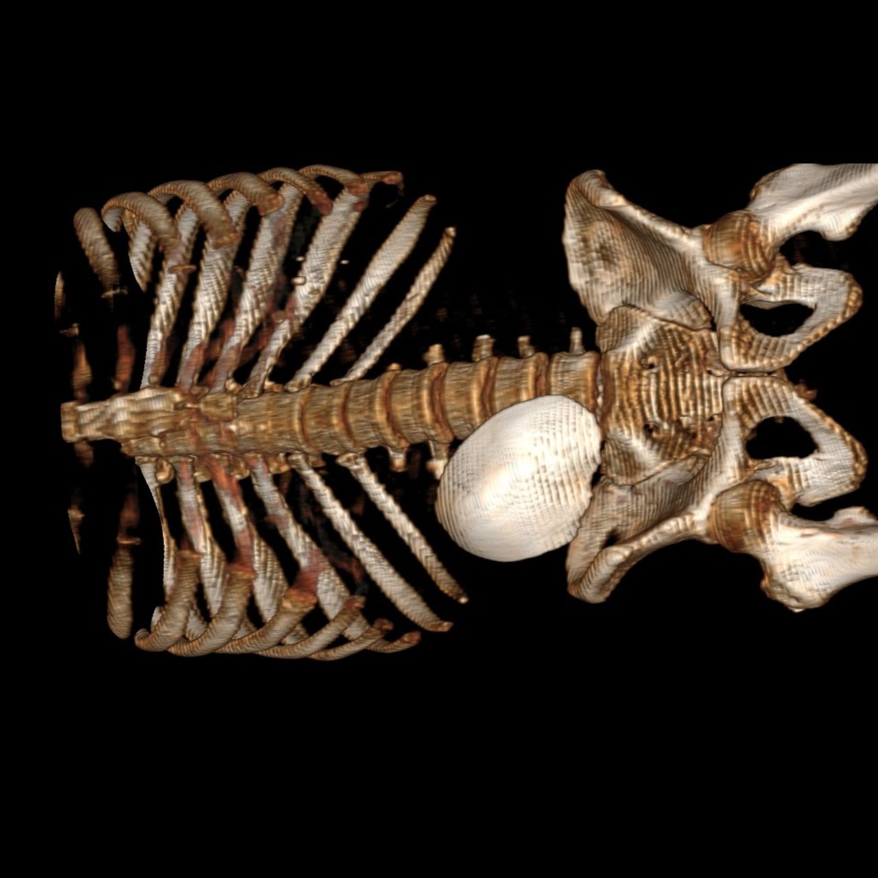 David Tafur Muñoz-1218