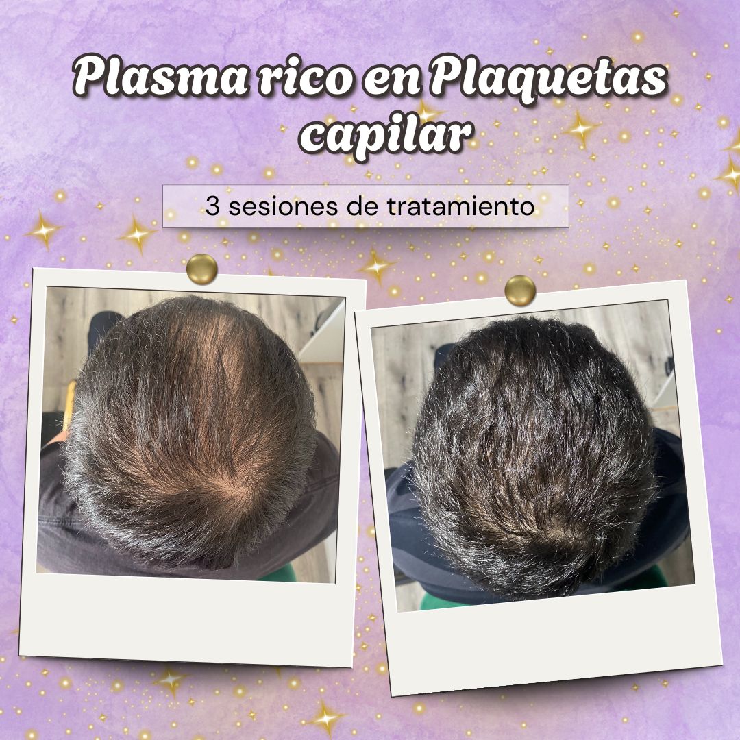 Scarlett Bartsch Ferrada-38