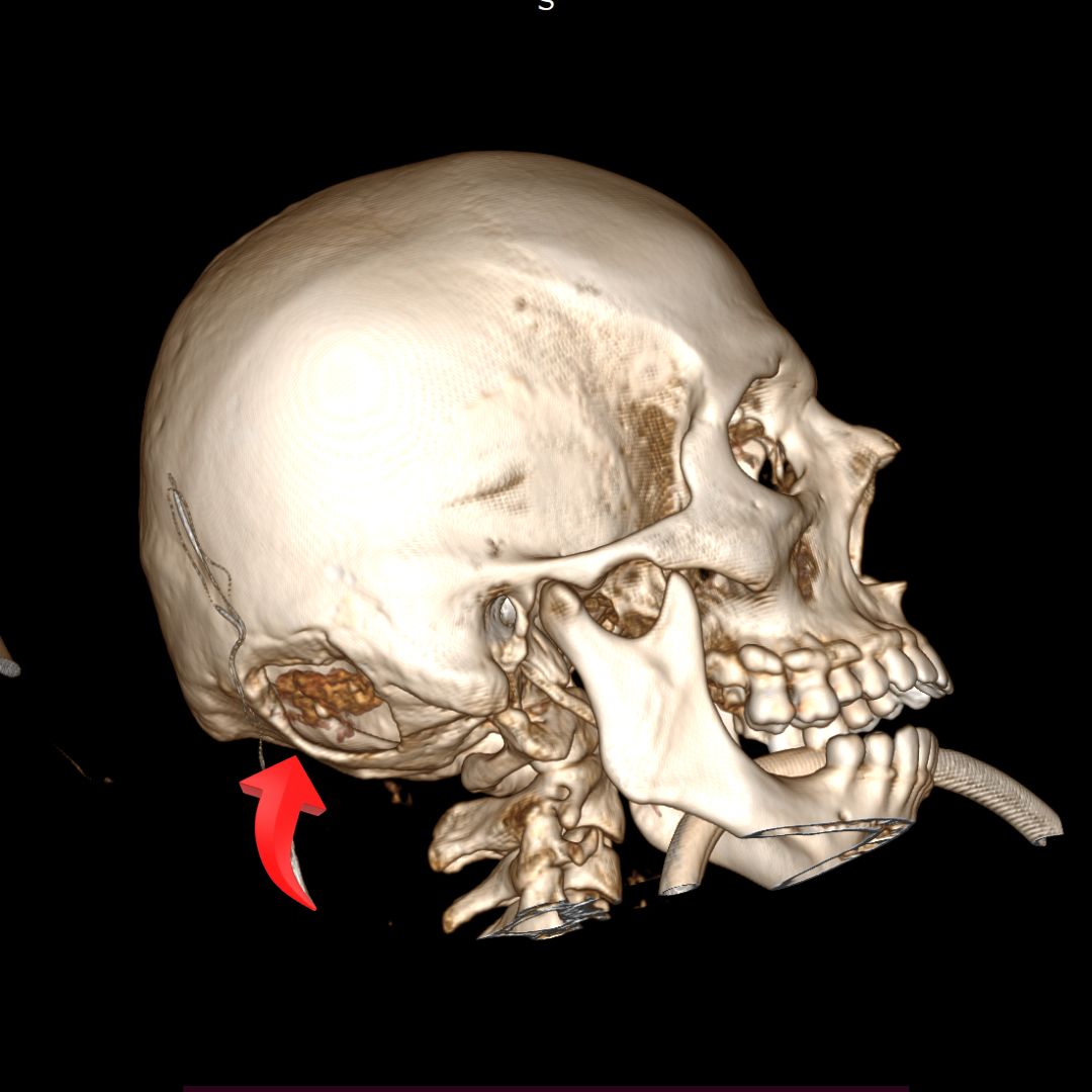 David Tafur Muñoz-2283