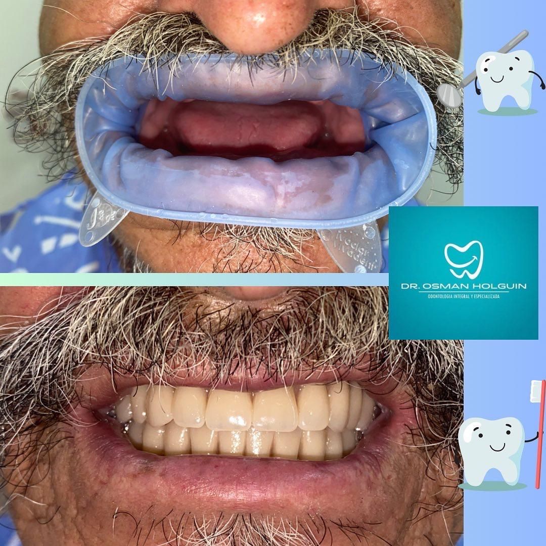 Osman Fernando Holguin Grisales-10