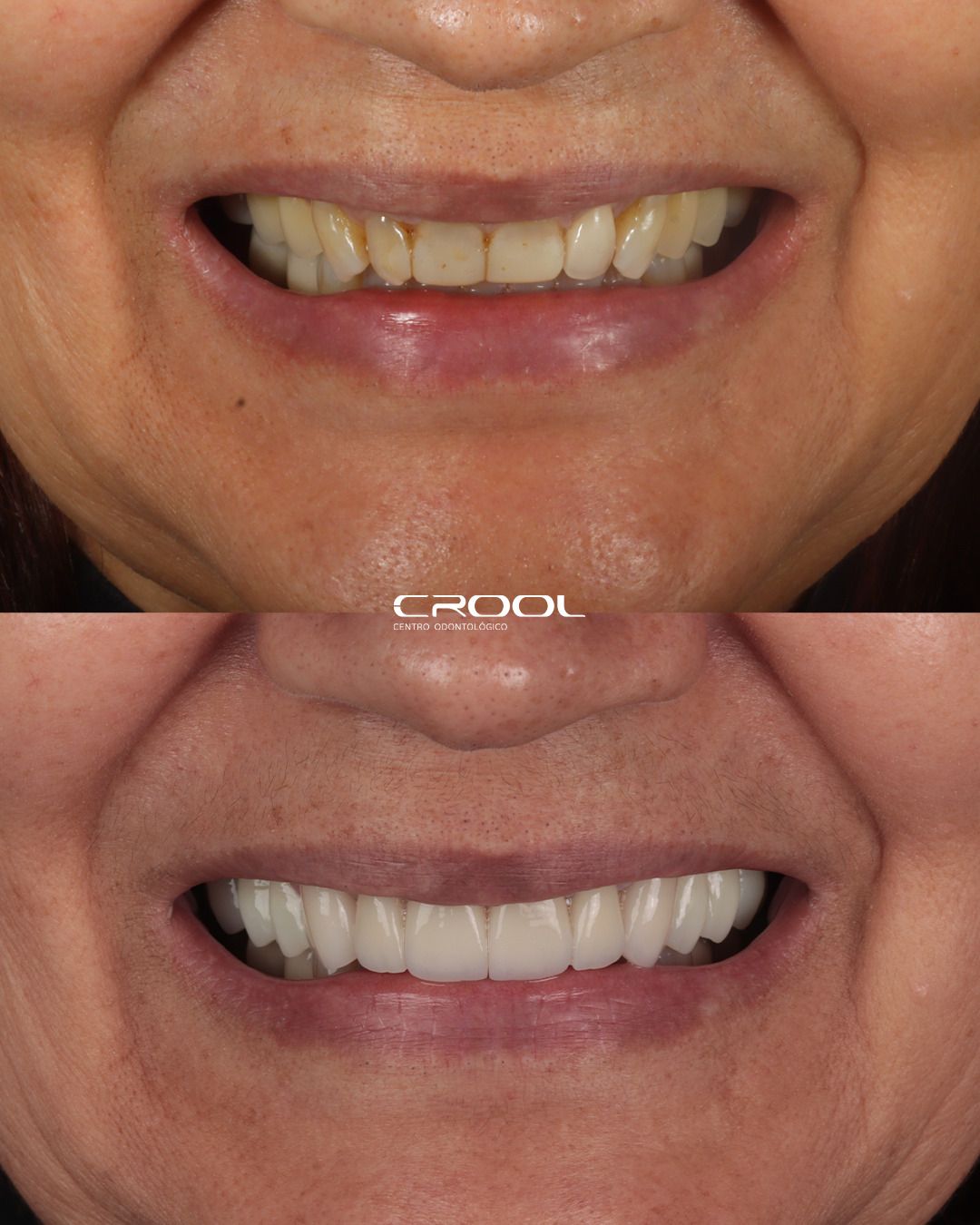 Frederico  Coelho-17