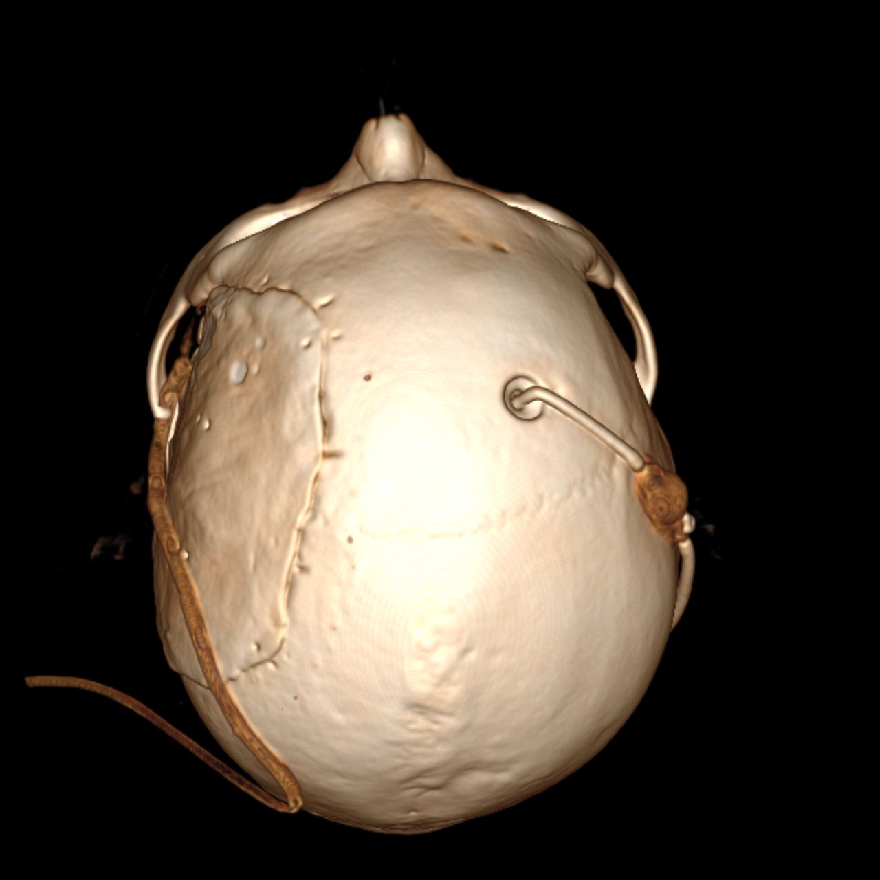 David Tafur Muñoz-1364