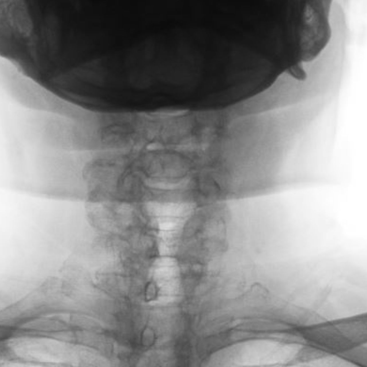 David Tafur Muñoz-2089