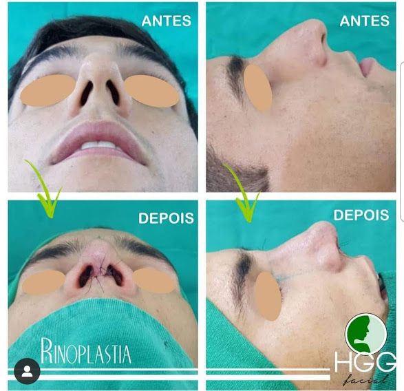 Hede Gurjão Gaspar-4