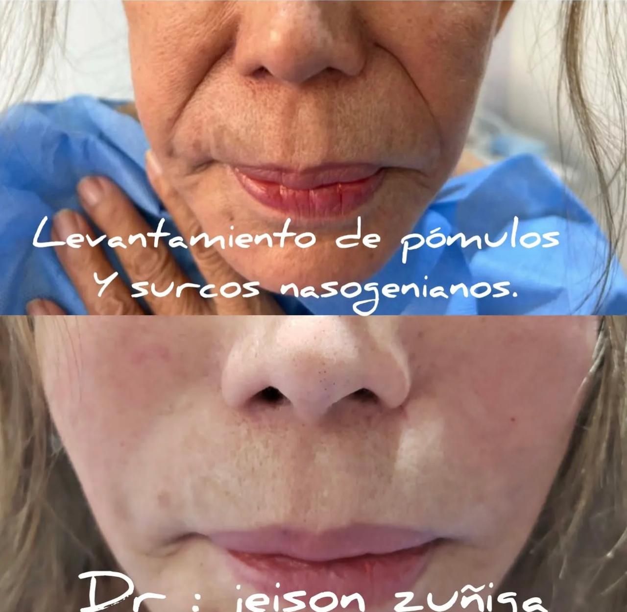 Jeison De Jesus Zuñiga Lara-9