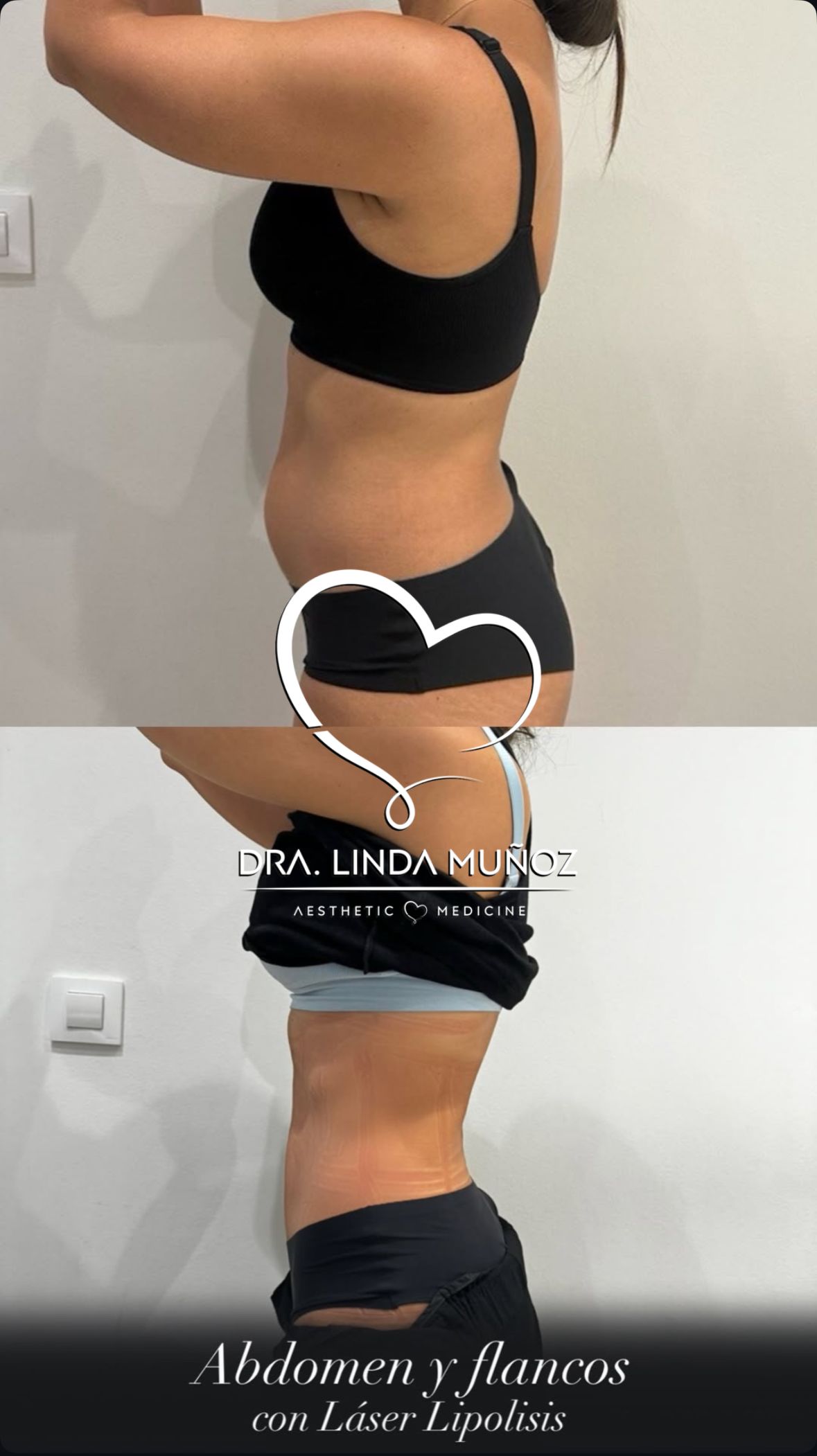 Linda Muñoz-19