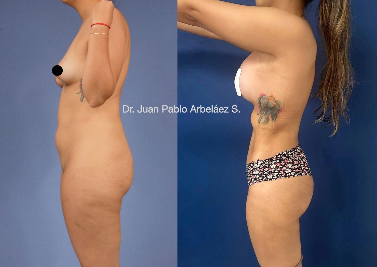 Juan Pablo Arbeláez Sierra-10