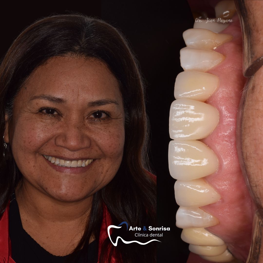 Jean Carlos Payano Arcos-1