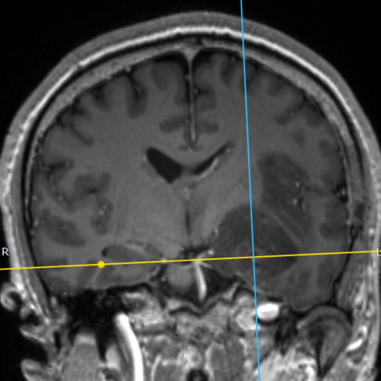 David Tafur Muñoz-1580