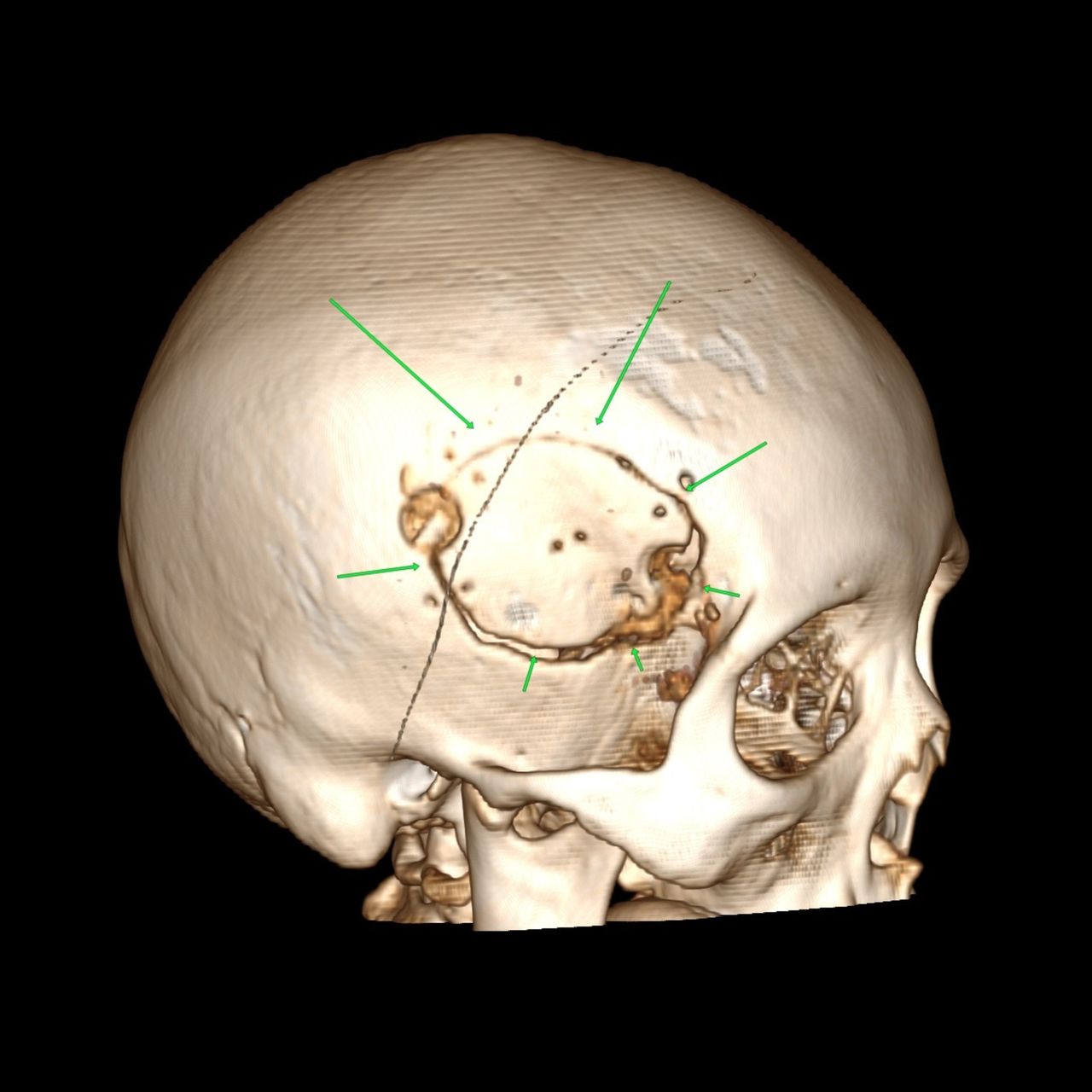David Tafur Muñoz-1288